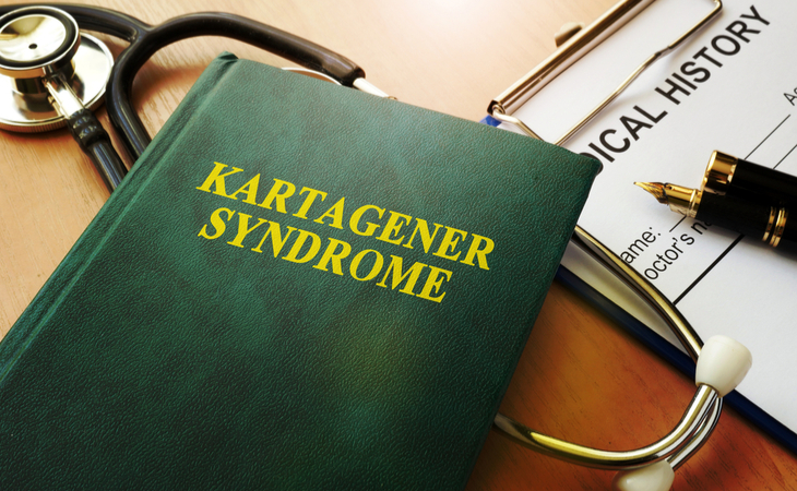 Sindrome di Kartagener