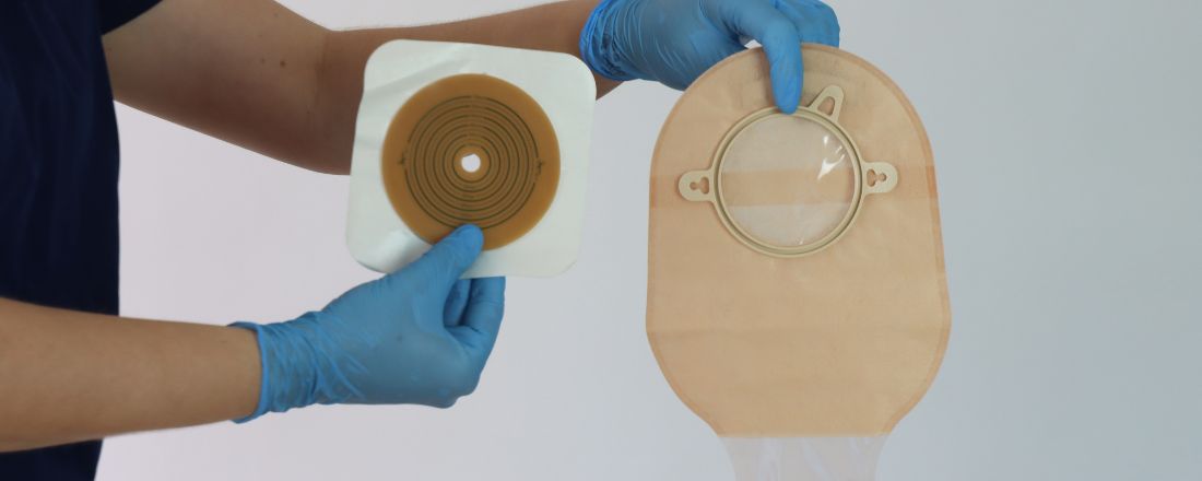 ileostomia
