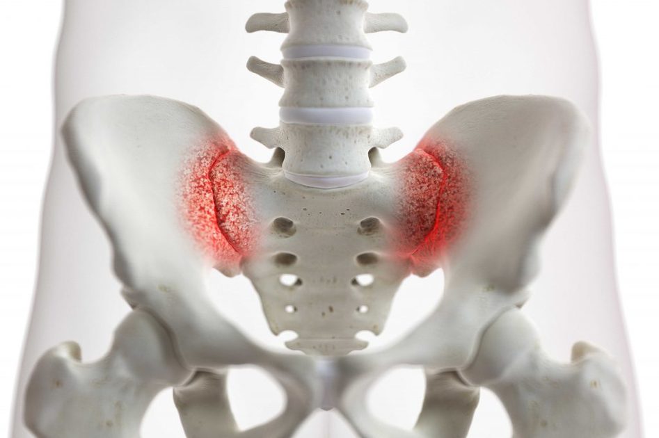 Osteoporosi e Smog: le Conseguenze sulle Ossa