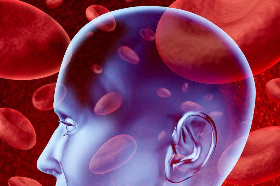 Il legame tra Ictus e sonno