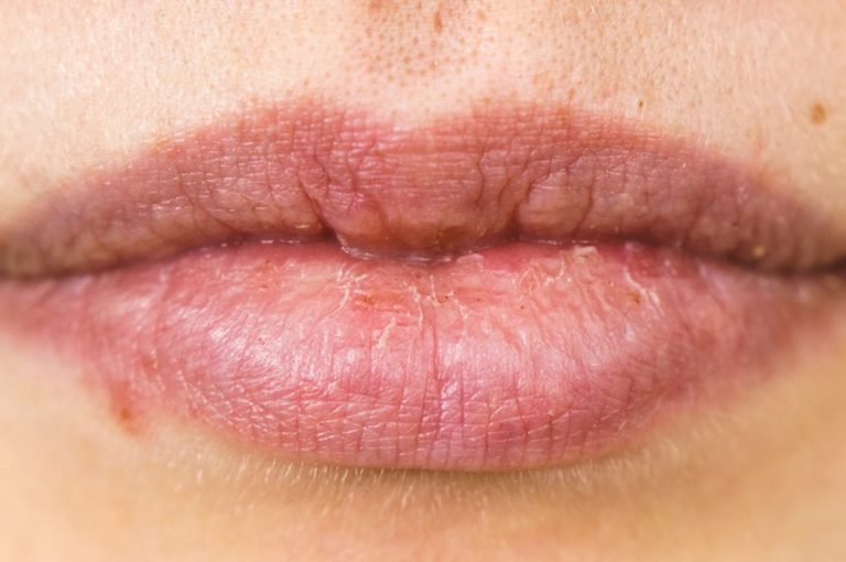 Roberta Nazaro, Autore a Le notizie di Pazienti.it ...