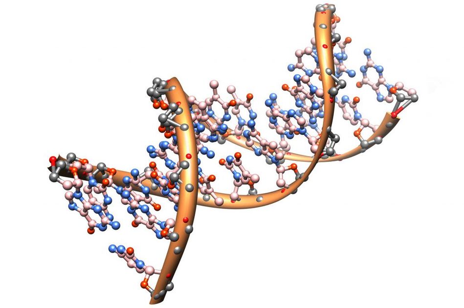 Sindrome di Angelman
