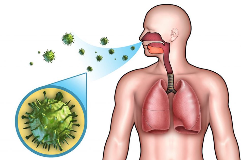 Polmonite da piumino: il primo caso in Scozia