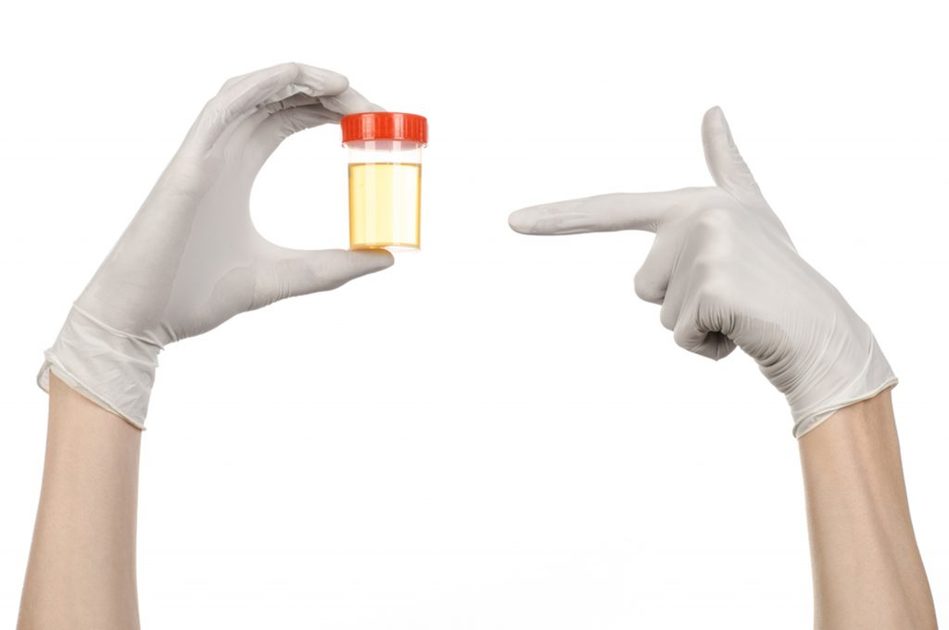 Esame delle urine: come leggere l'esame