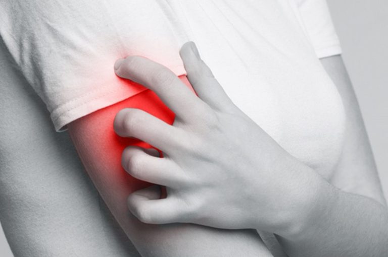 Allergia alla penicillina: come riconoscerla