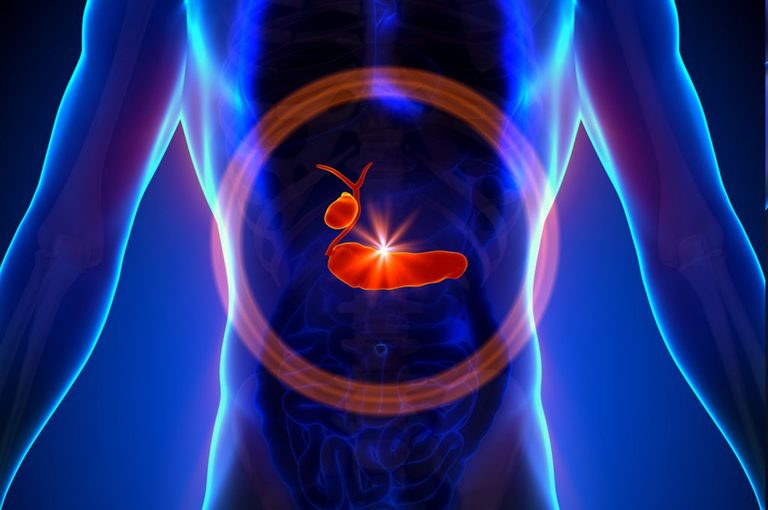 Tumore al pancreas: seconda causa di morte entro il 2030