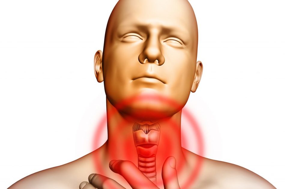 Sintomi della Tracheite e Come Riconoscerla