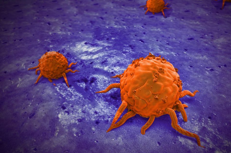 Tumore del Sangue: i Sintomi