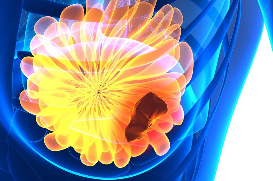 Tumore al Seno, Gravidanza e Menopausa