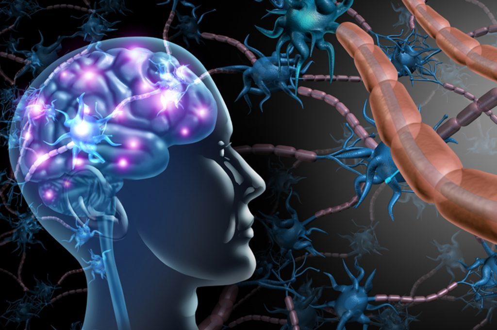 Alzheimer e emicrania: il legame