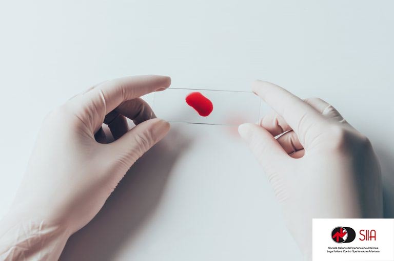 Cuore: gli Esami del Sangue