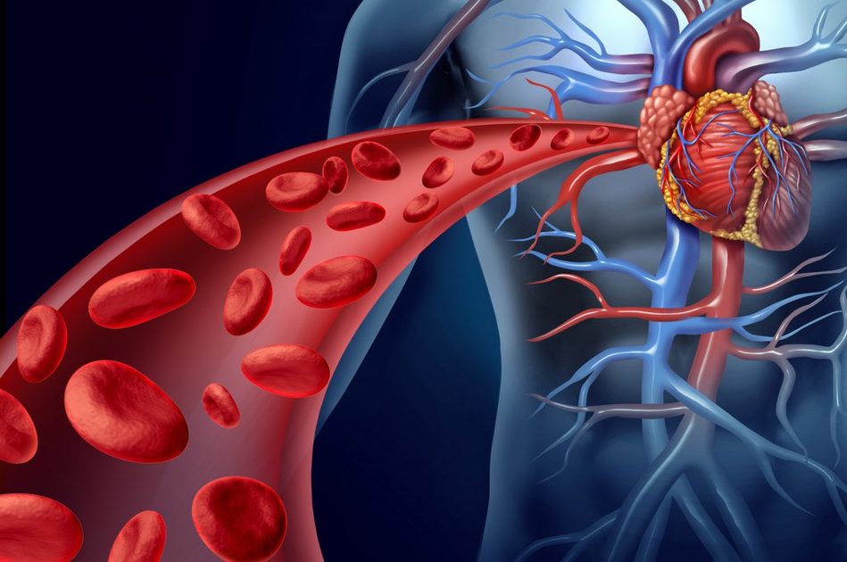 Ferro e rischio di ictus