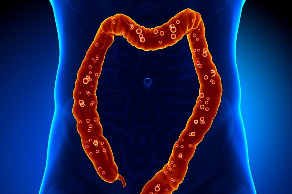 Colon irritabile: addio colonscopia?