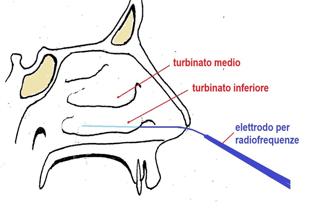 Perché è così importante Respirare Bene dal Naso? | Pazienti.it