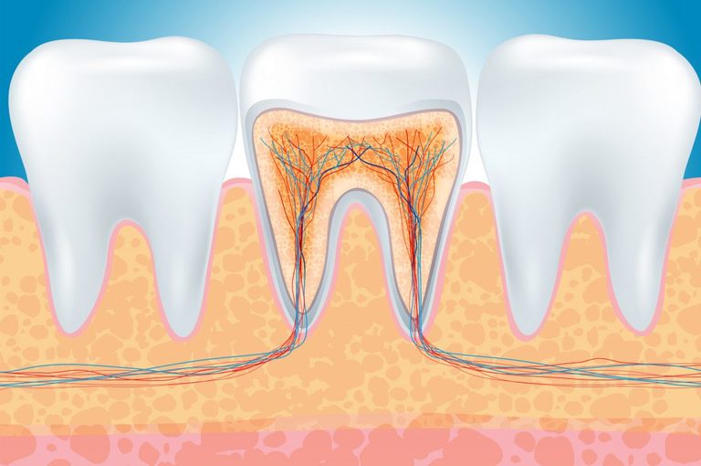 Rimedi naturali contro il mal di denti
