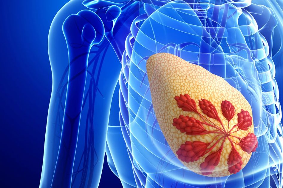 Microcalcificazioni al seno: cosa fare?