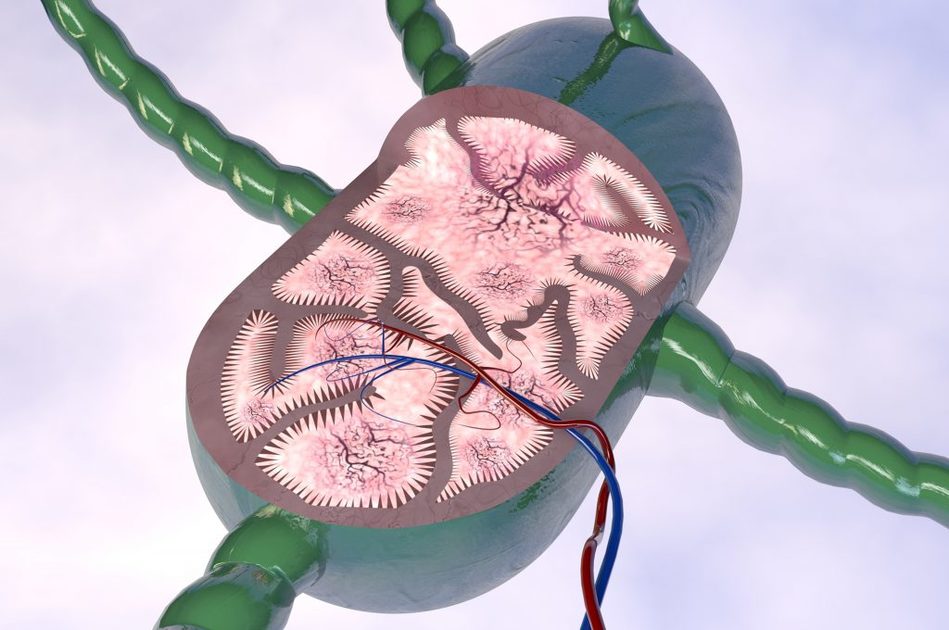 Linfonodo sentinella