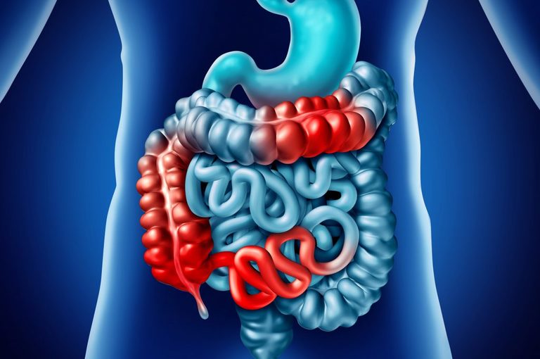 Terapia biologica per malattie croniche intestinali