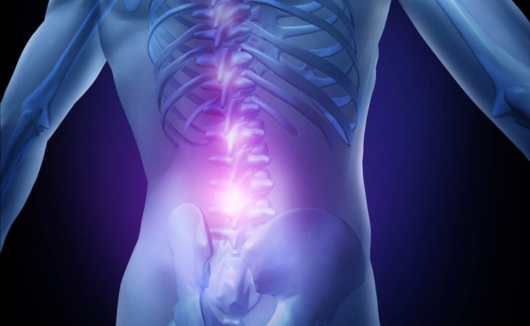 Mal di schiena: Cause