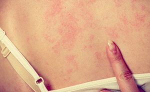 Dolore al seno e gonfiore: ecco tutte le cause | Pazienti.it