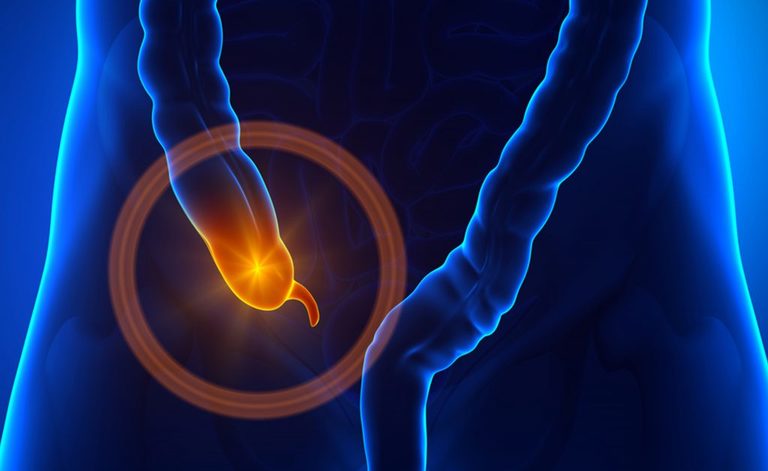 Appendice e Morbo di Parkinson: svelato un legame