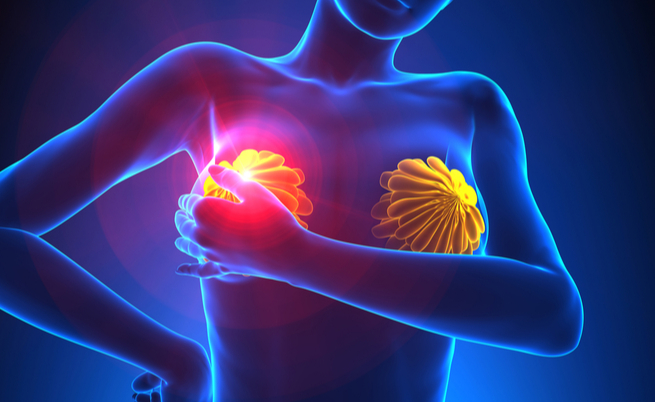 Tumore al seno: sintomi visibili e prevenzione