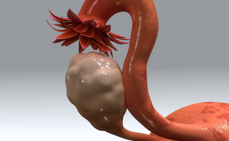 Quali sono malattie difficili da diagnosticare?