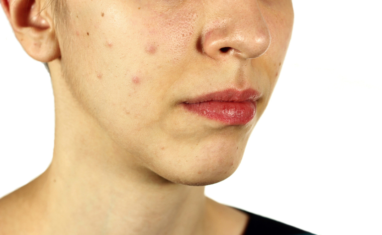 Errori che si commettono con la pelle