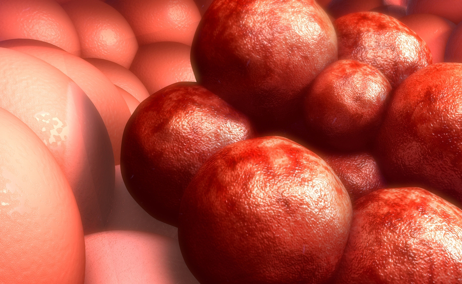 Pet tac: perché si fa?