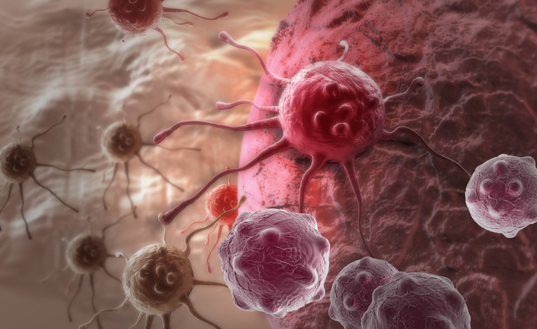 Tumore al seno: la diagnosi