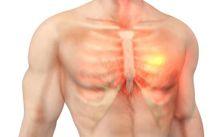 Le cause del dolore al petto (dolore toracico)