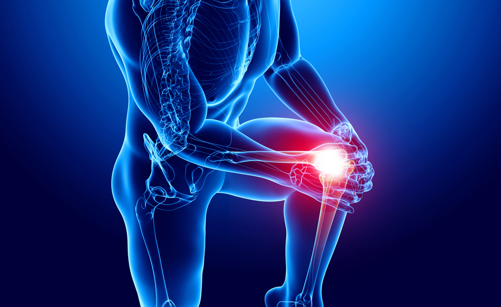 cisti di baker: come riconoscerla e curarla