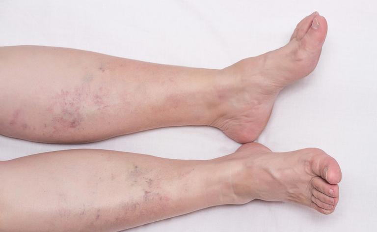 Alimenti diuretici e drenanti