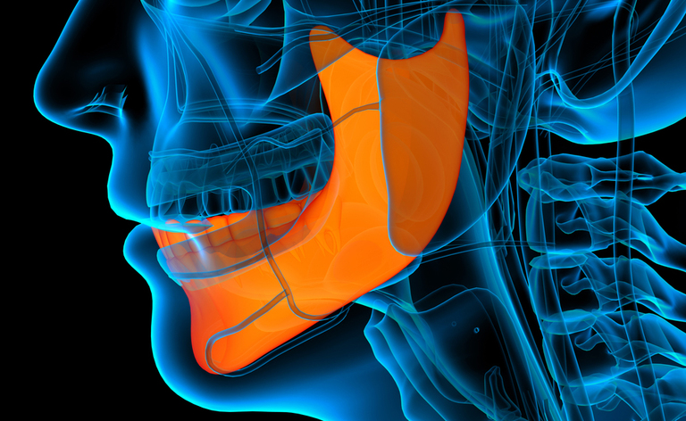 Artrite reumatoide e parodontite: il legame