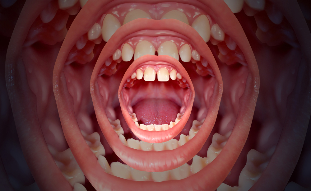 Perdita della voce cosa fare