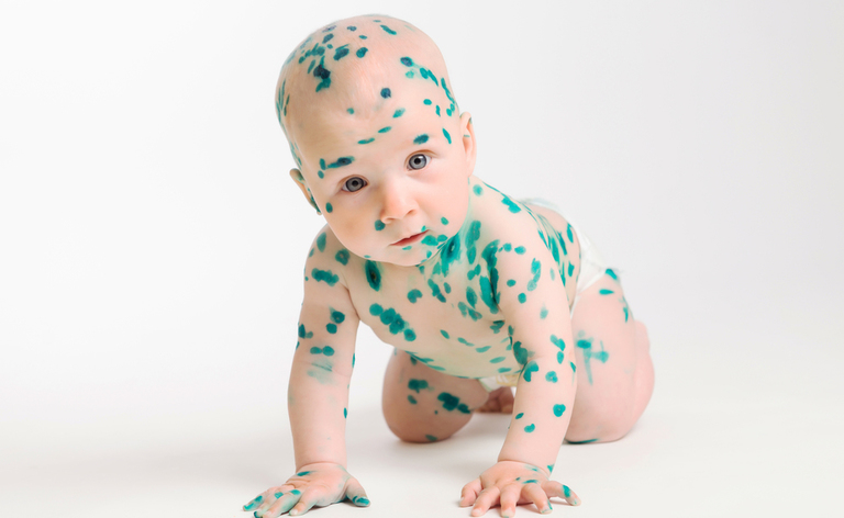 Vaccini: i pericoli in Italia