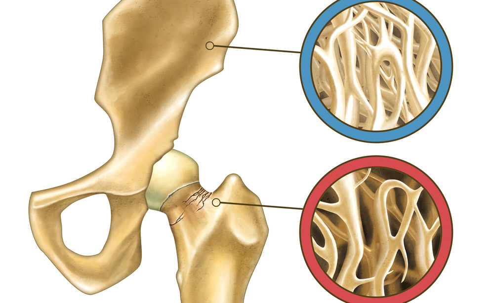 Magnesio e Vitamina D: per la salute delle ossa