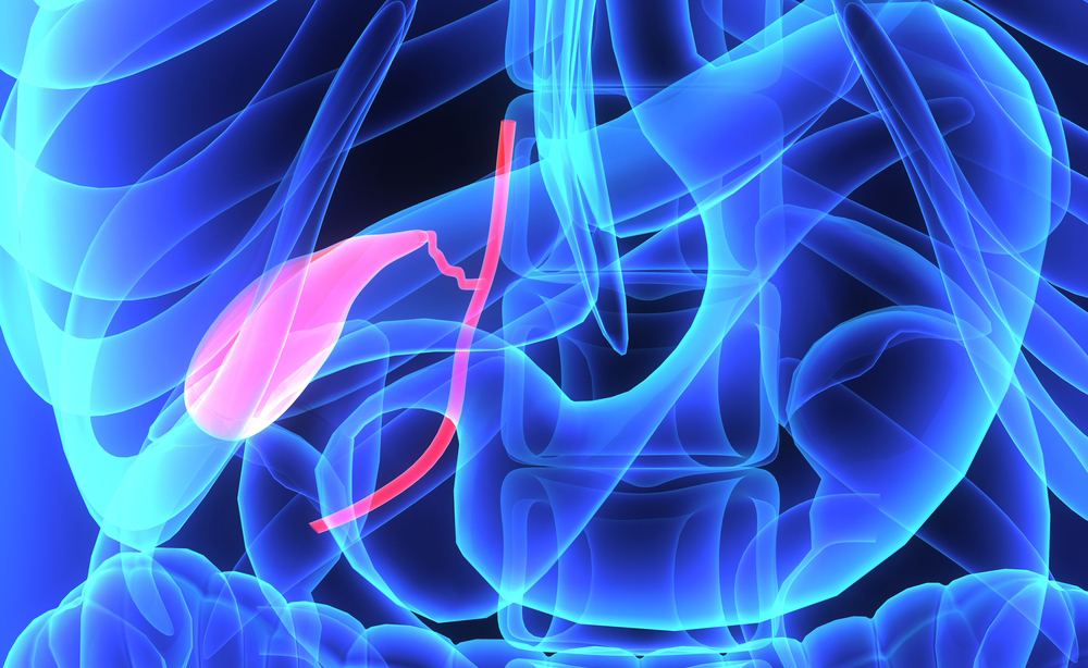 calcoli alla colecisti: quando vanno operati?