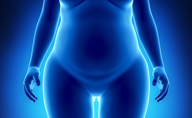 diabete e chirurgia bariatrica: i benefici