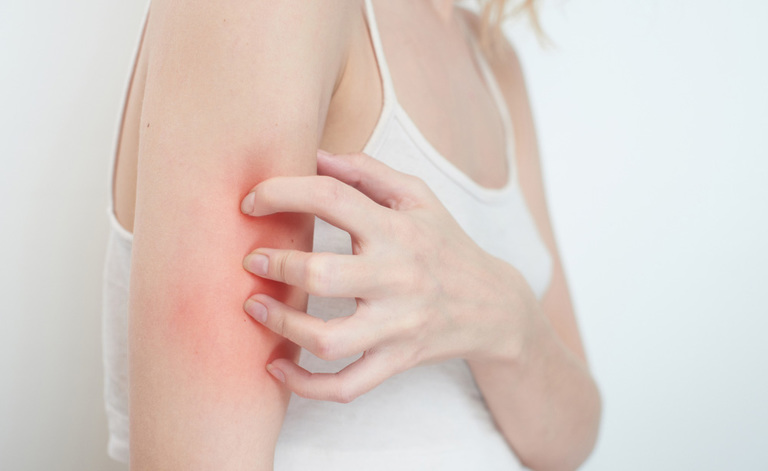 prurito: come combatterlo con la luce