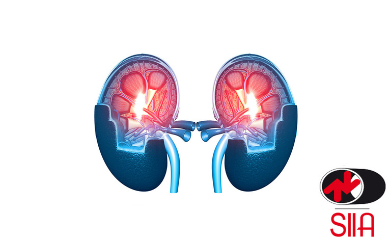 Ipertensione e Disturbi ai Reni: ecco qual è il Legame