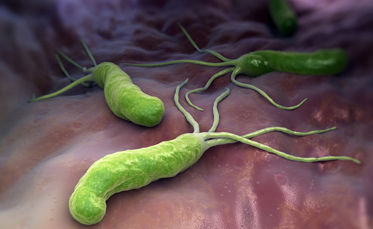 H. Pylori: come si diagnostica a casa