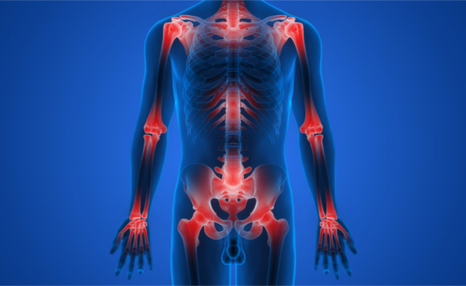 Flogosi cronica: i rischi e i fattori di rischio