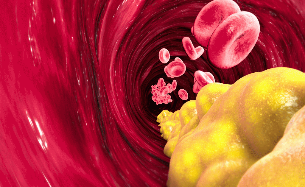 Colesterolo: gli effetti