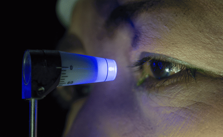 Glaucoma: i sintomi e le cause del disturbo