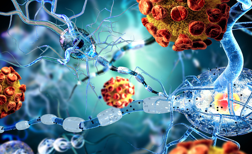 neuroblastoma: i farmaci per la cura