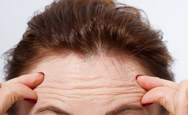 rughe in fronte e problemi cardiaci: il legame