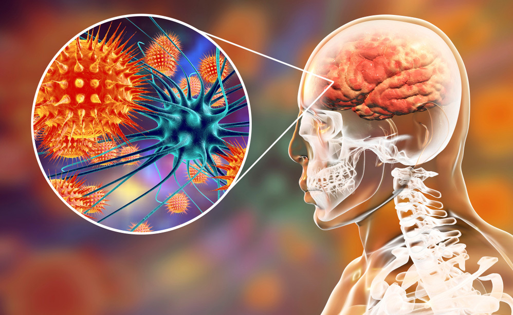 Vaccini e Autismo: il Legame