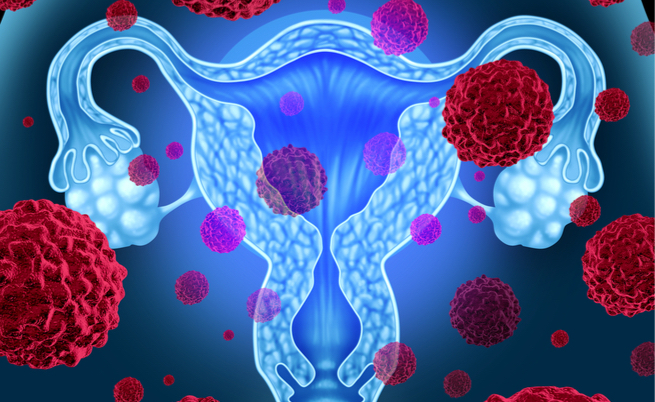 Test HPV per il Papilloma Virus Humano