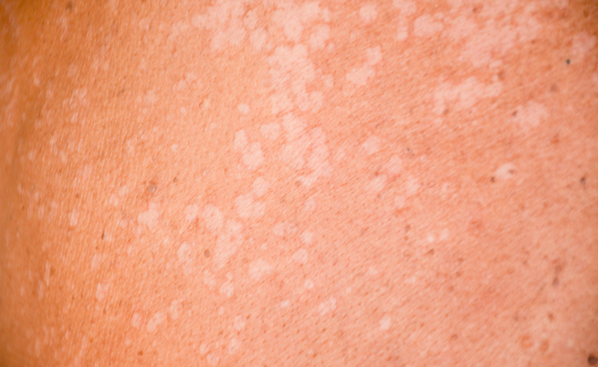 fungo di mare: come riconoscerlo